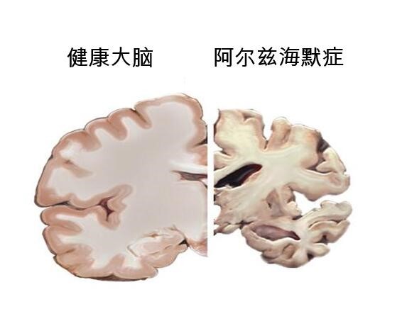 80.jpg